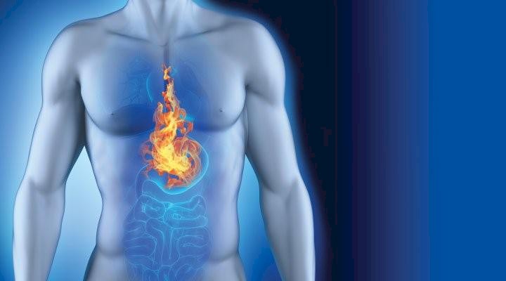 Three Methods to Get Rid of Acid Reflux Naturally